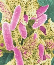 Override of the title Noorderlicht - e. coli