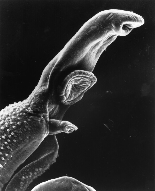 Override of the title schistosoma